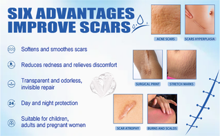 Miasaki Scar Removal Cream