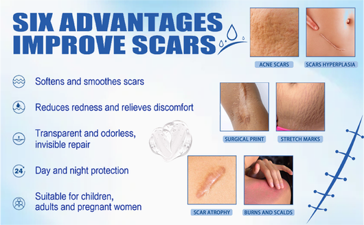 Miasaki Scar Removal Cream