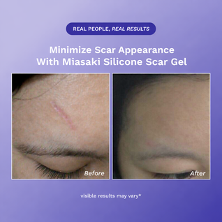 Miasaki Silicone Scar Gel