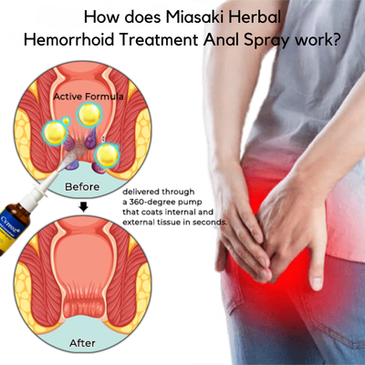 Miasaki Fast Herbal Hemorrhoid Spray