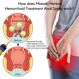 Miasaki Fast Herbal Hemorrhoid Spray