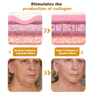 Miasaki Botox Bee Venom Lifting Cream